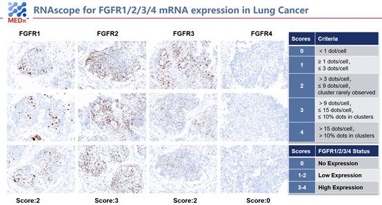 RNAscope法评估FGFR1234的mRNA表达水平